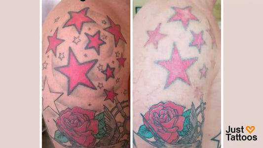 Before and after showing how to fade a tattoo fast with star and rose design losing color on the upper arm